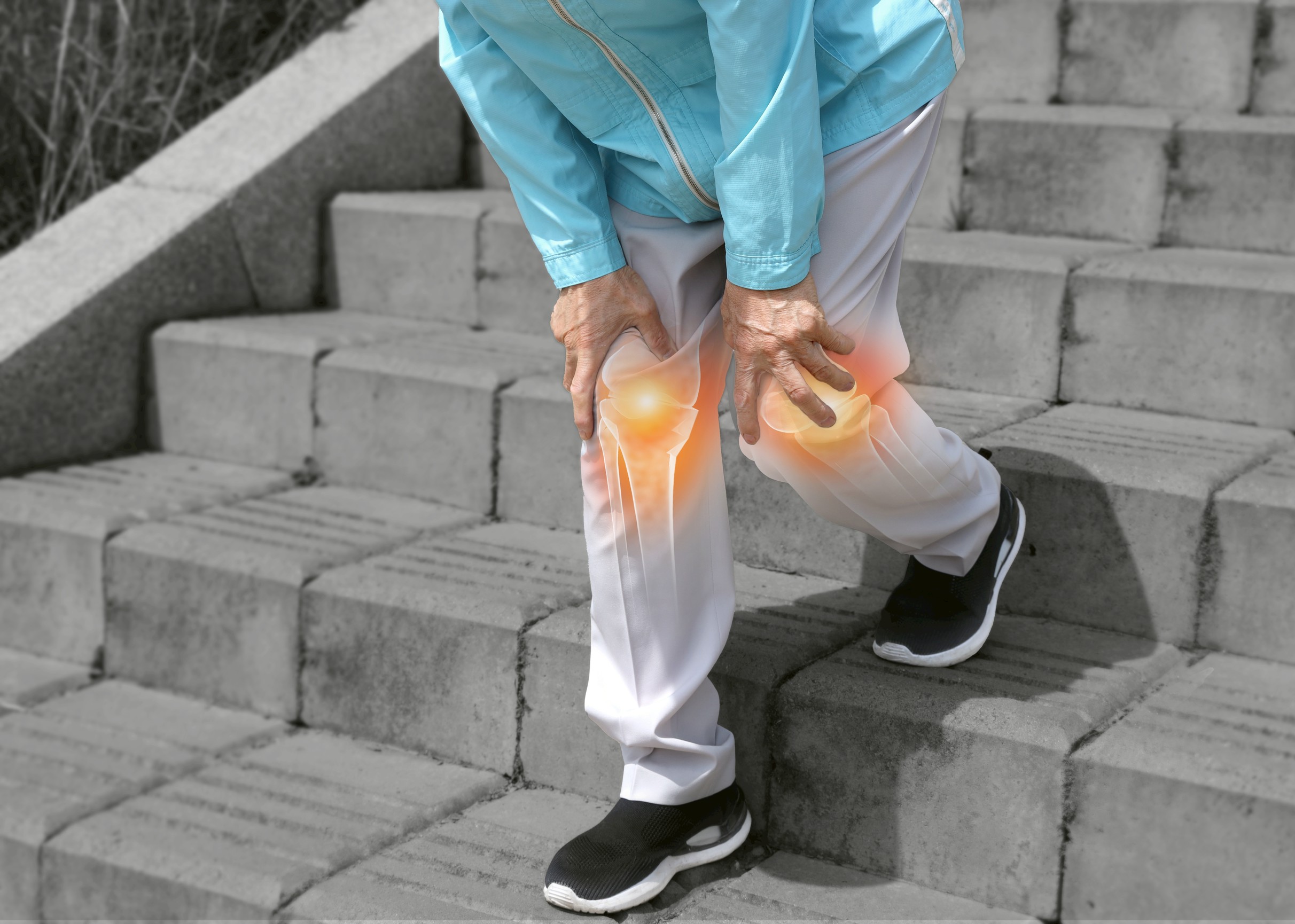 “จับเทรนด์ผู้สูงอายุไทย : ค่าใช้จ่ายรักษาเข่าเพิ่มทุกปี ผู้เชี่ยวชาญแนะวางแผนเลือกการผ่าตัดอย่างมีข้อมูล”